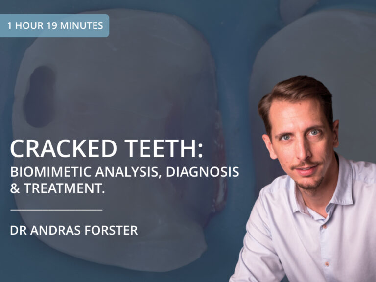 Cracked Teeth: Biomimetic Analysis, Diagnosis and Treatment – Dr Andras Forster