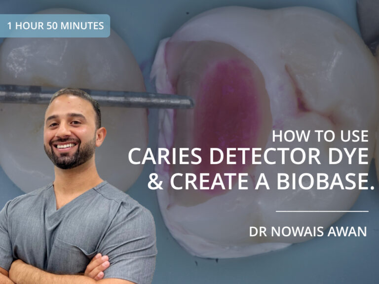 How to Use Caries Detector Dye and Create a Biobase - Dr Nowais Awan