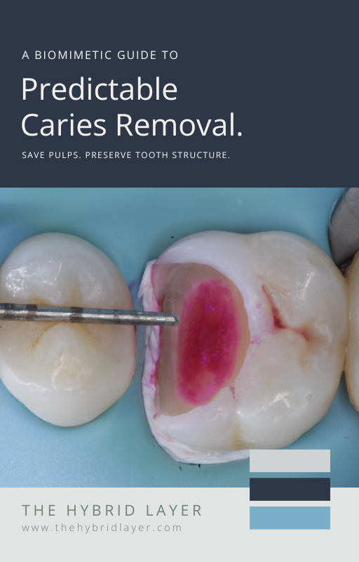 Biomimetic Caries Removal eBook