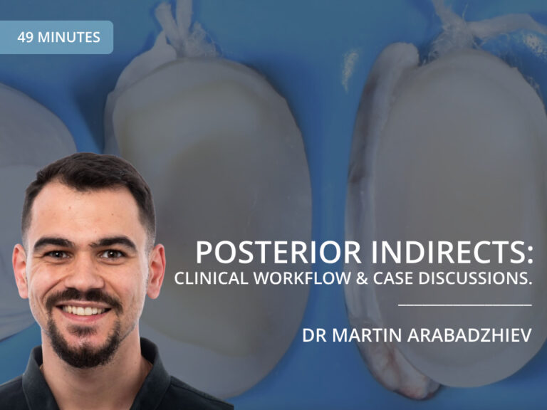 Dr Martin Arabadzhiev - Posterior Indirect Restorations Lecture