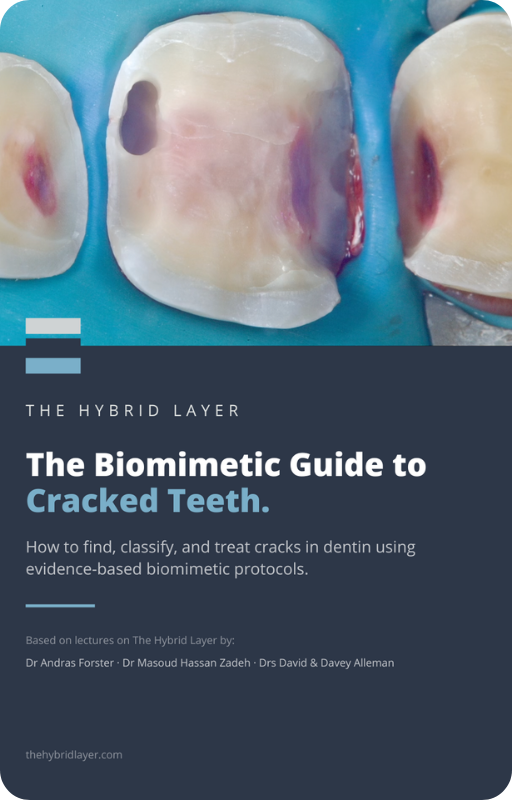The Biomimetic Guide to Cracked Teeth